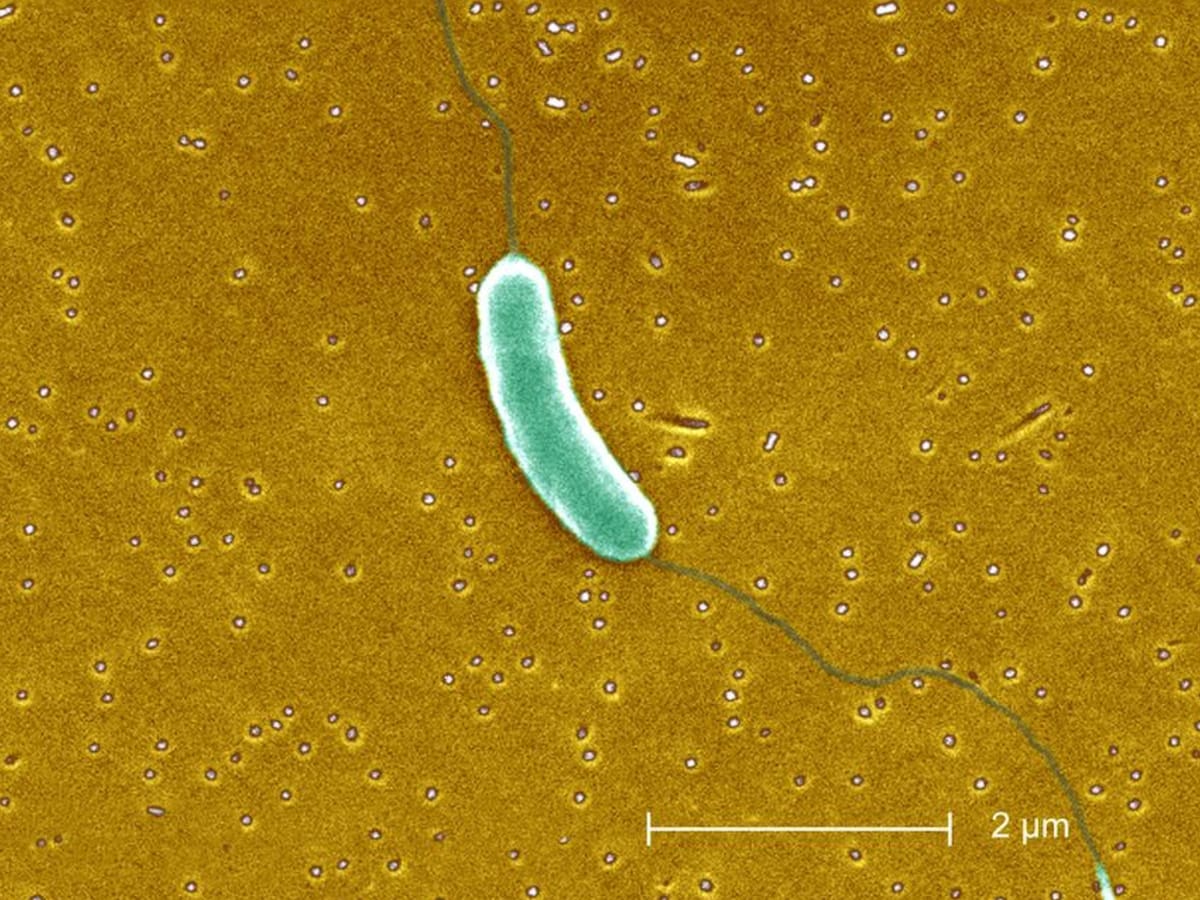 Bacteria ‘come carne’ ha dejado 12 personas muertas en Estados Unidos